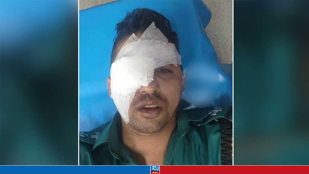 হিজড়াদের হামলায় চোখ হারালেন এসআই