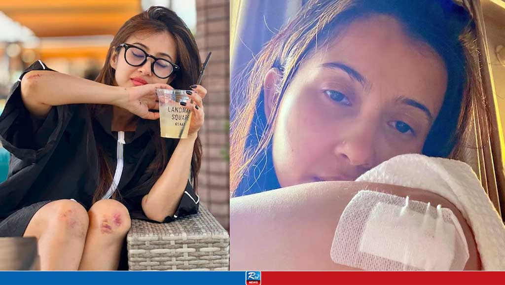 Monami Ghosh injured in japan