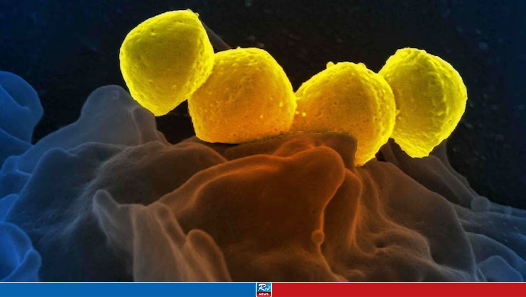 Flesh-eating bacteria spreads in Japan