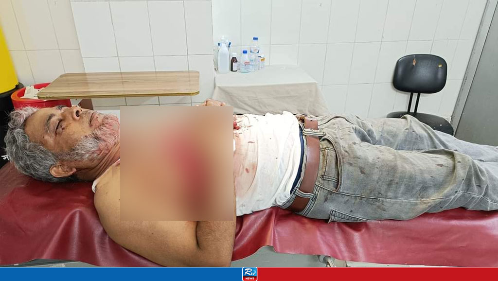 পুলিশের রাবার বুলেটে জাবি শিক্ষক আহত