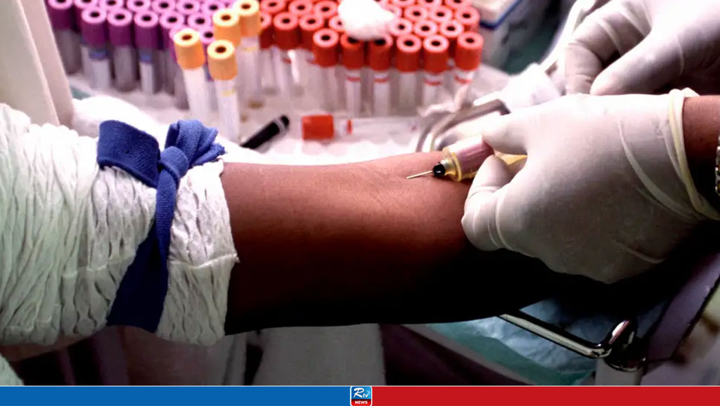 HIV Treatment Breakthroughs: Namibia's Success Story