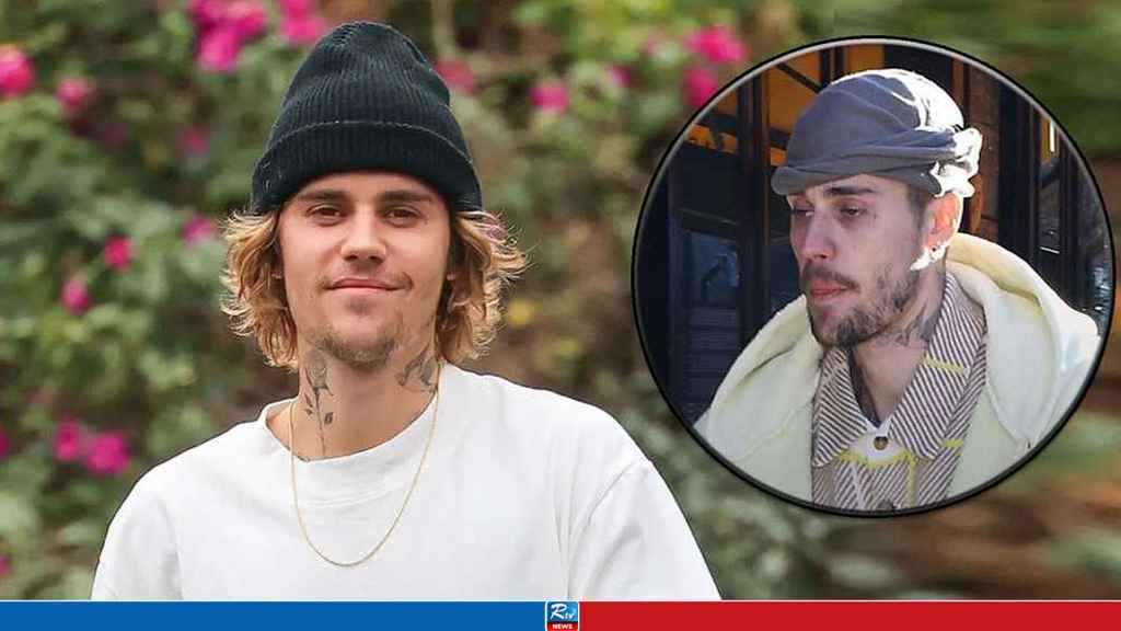 Justin Bieber's Drastic Change in Appearance Shocks Fans