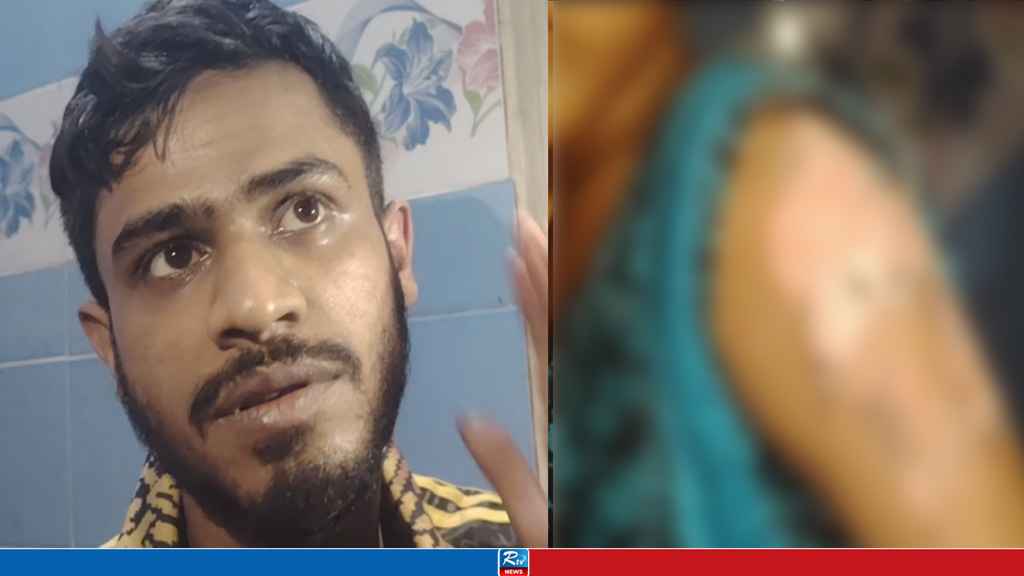 ৪ বছরের শিশুর গায়ে সৎ বাবার গরম ছুরির ছ্যাঁকা