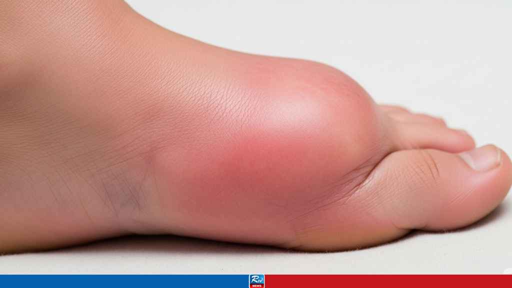 পায়ের লক্ষণেই ধরা পড়ে ডায়াবেটিস