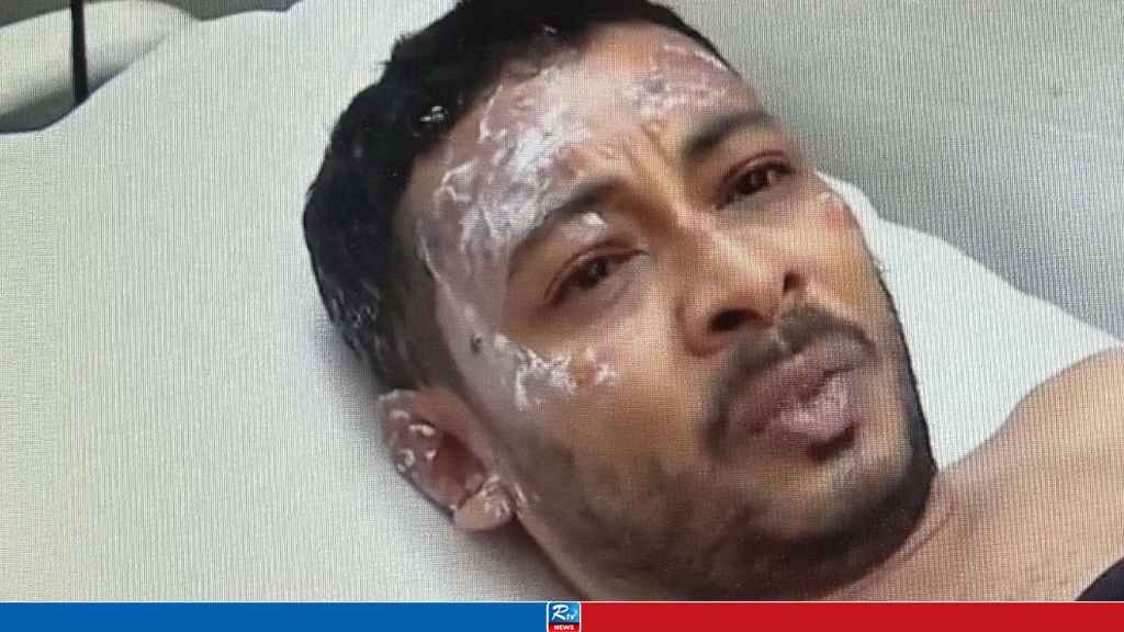 বিমান বিধ্বস্ত: আগুন থেকে বেঁচে ফেরা এক শিক্ষকের ভয়াবহ বর্ণনা