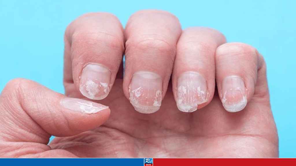 nail